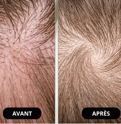 Shampoing Réparateur Acides Aminés - Nettoie Sans Assécher la Fibre