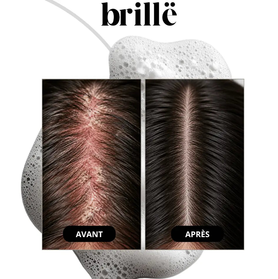 Shampoing Régénérant Cuir Chevelu Sensible - Sans Sulfate