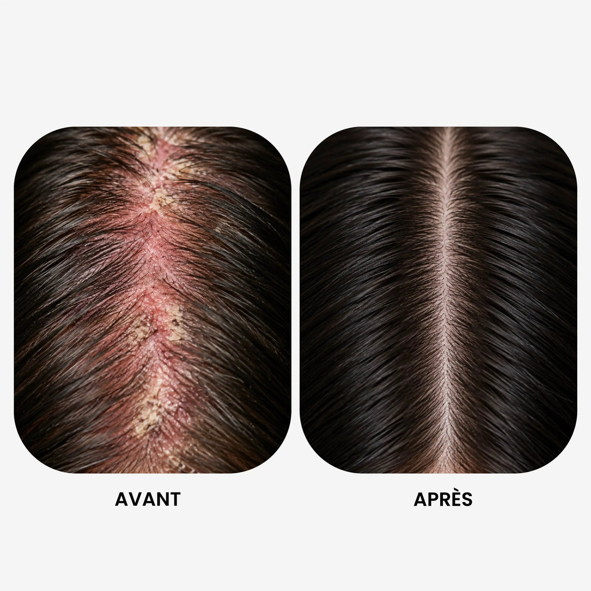 Shampoing Régénérant Cuir Chevelu Sensible - Sans Sulfate